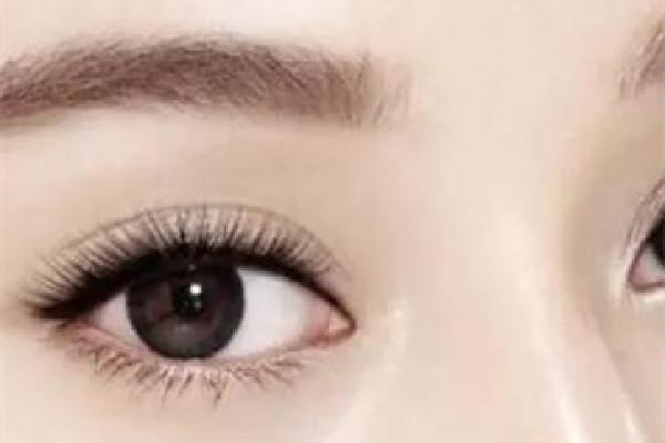 武漢雙眼皮修復手術(shù)哪里做的比較好 武漢雙眼皮修復價格表